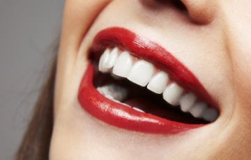 Безопасно ли отбеливание зубов?